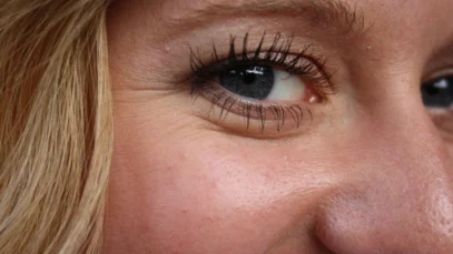 eliminar-patas-de-gallo-wide_webp